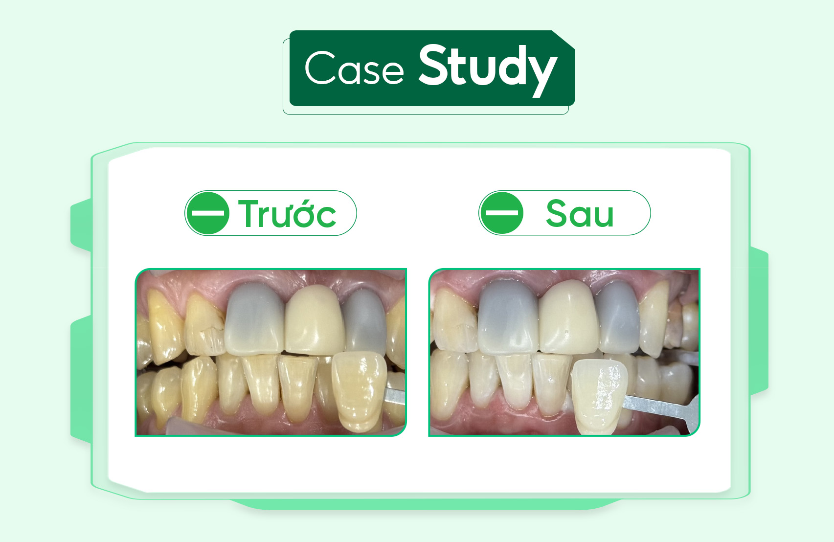 Case-tay-trang ( 1 )